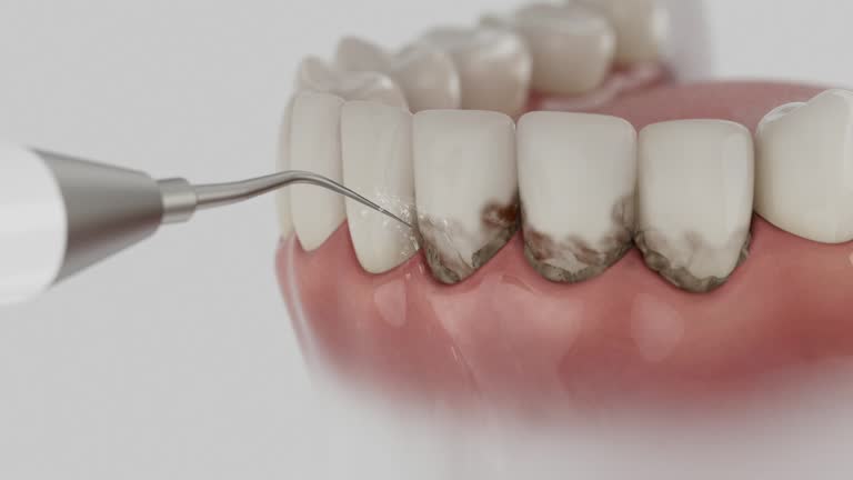 Reliable Dental contractor in Bardmoor, FL by Dentist Open Now
